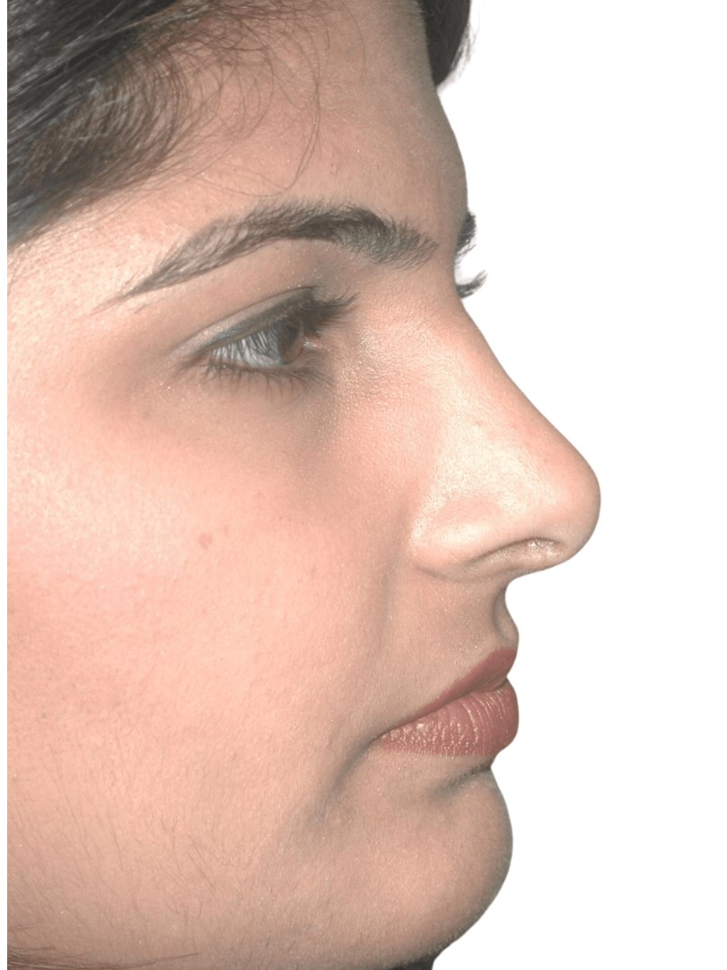 After Image