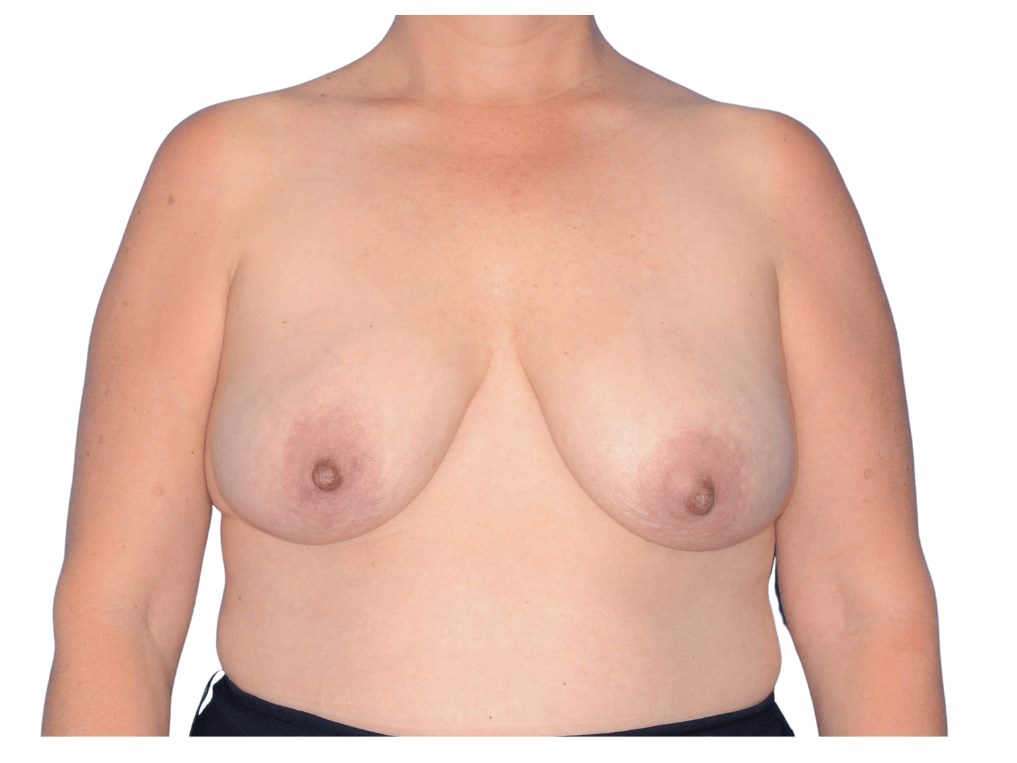 Before Image