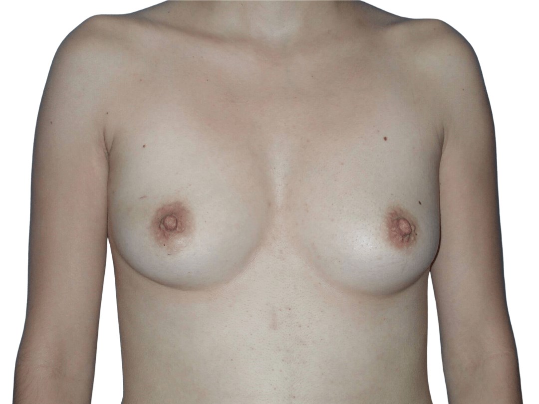 Before Image