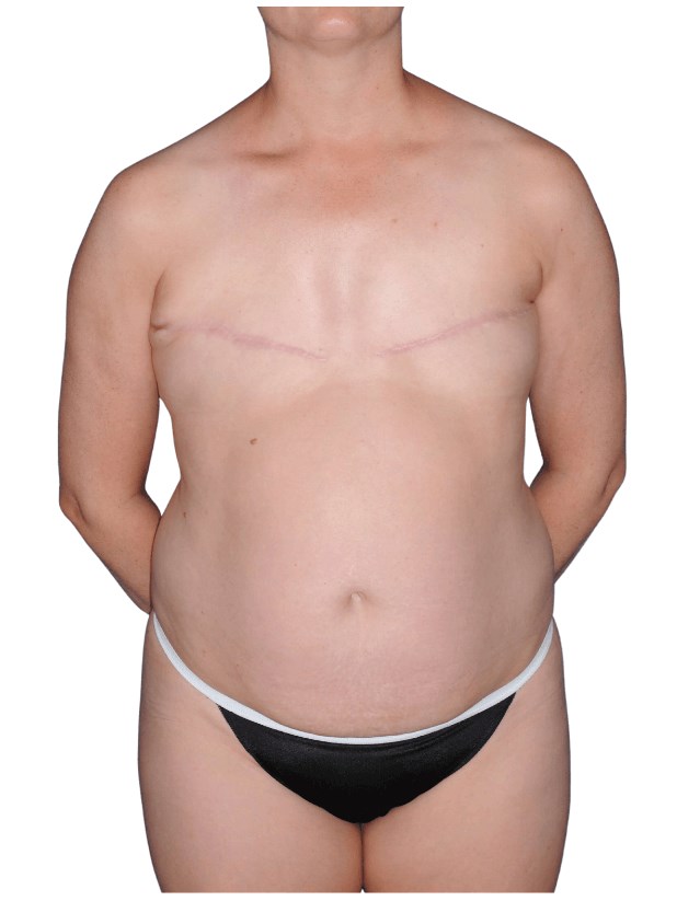Before Image