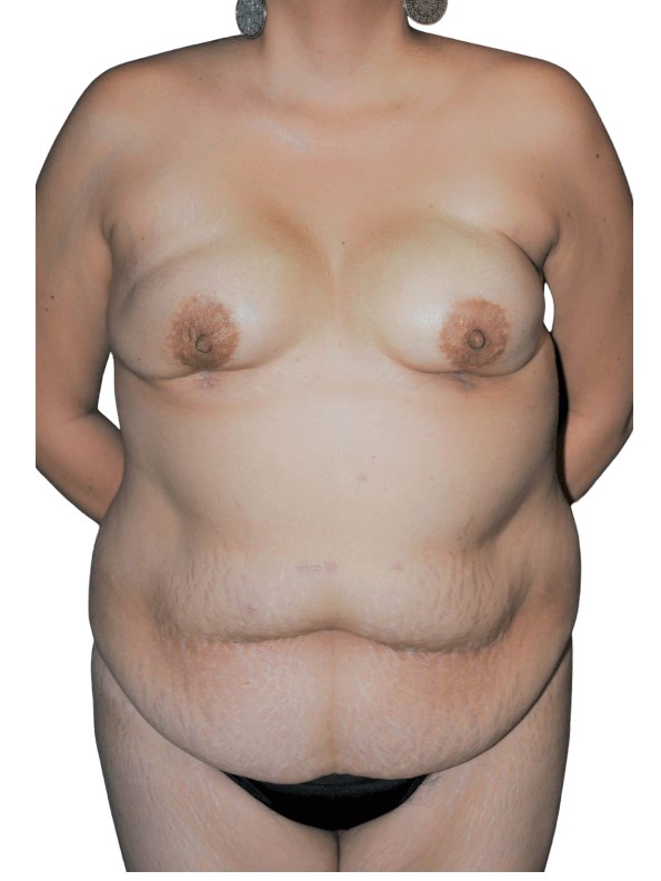 Before Image