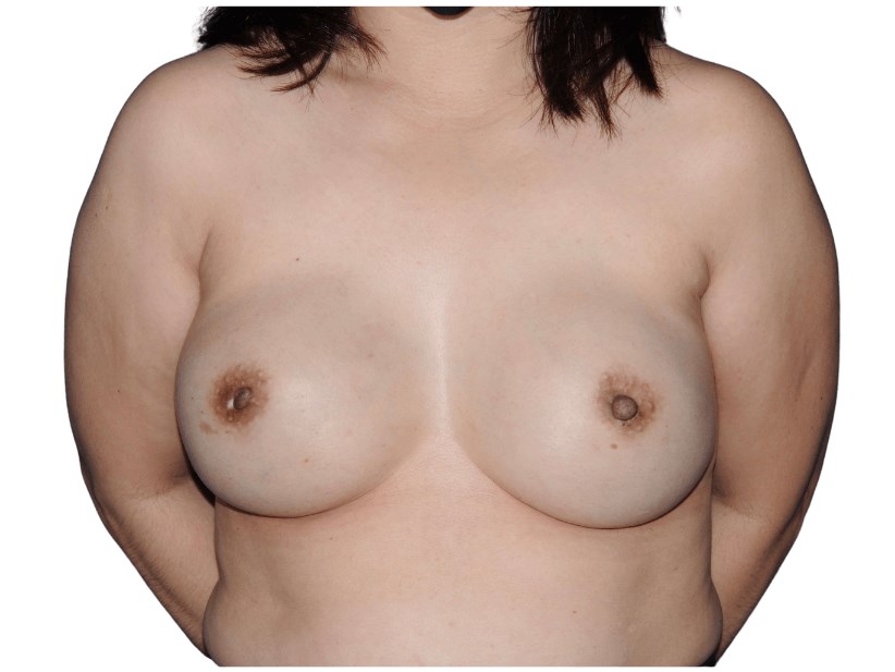 After Image