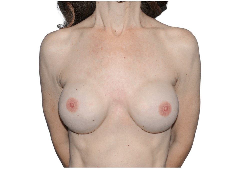 After Image