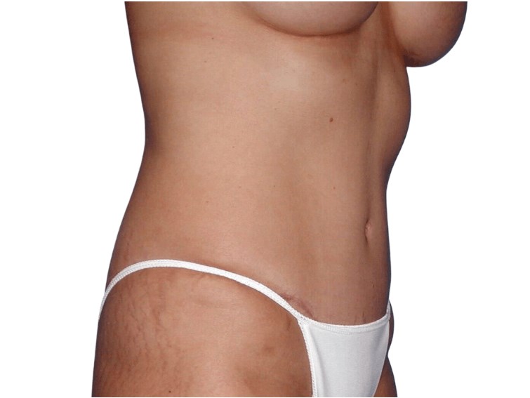 After Image