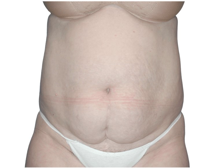 Before Image