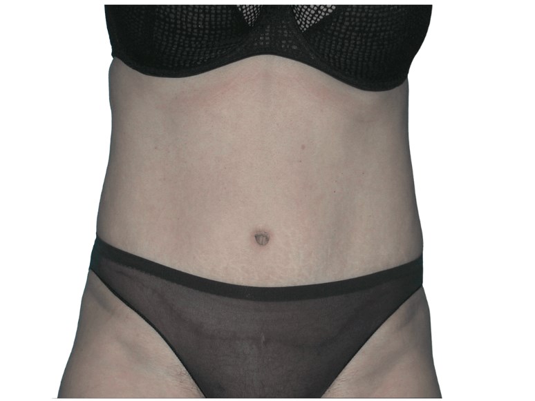 After Image