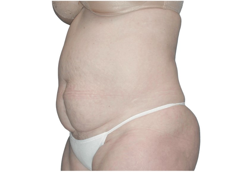 3/4 Before 3/4 Before