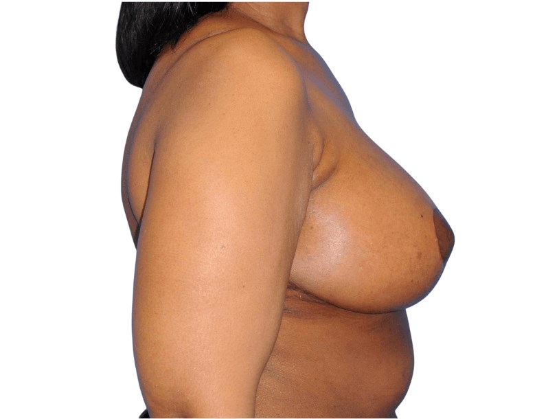 Side After Side After