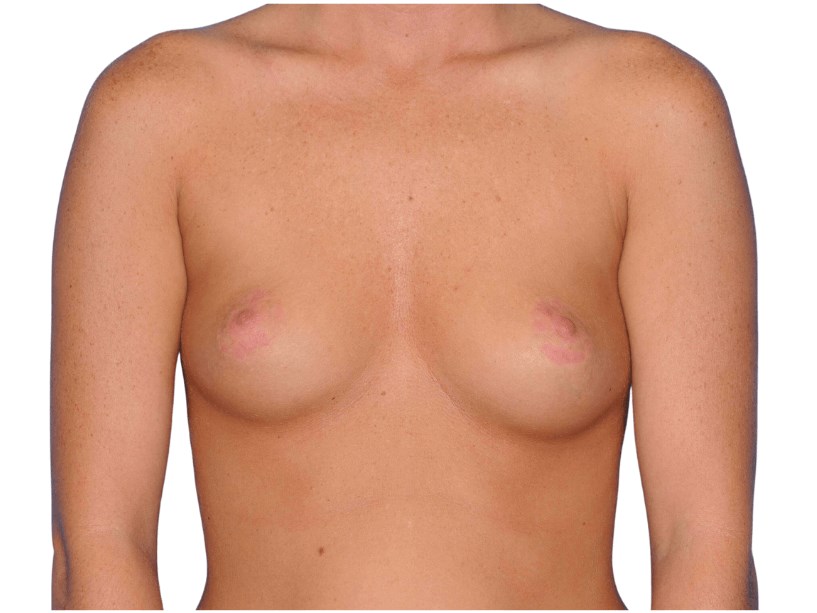 Before Image