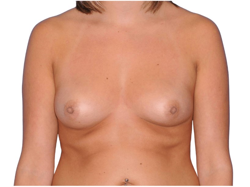 Before Image