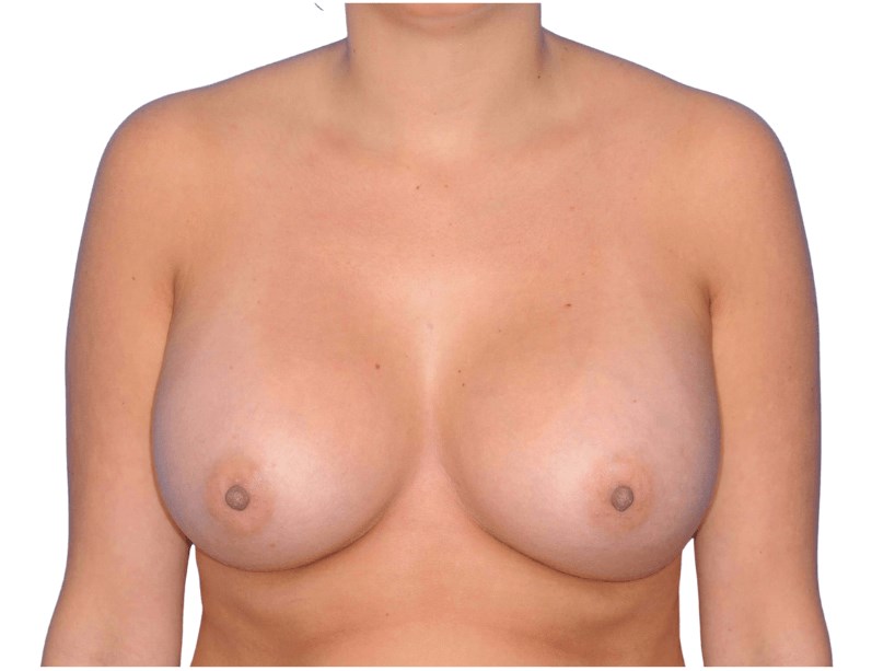 After Image