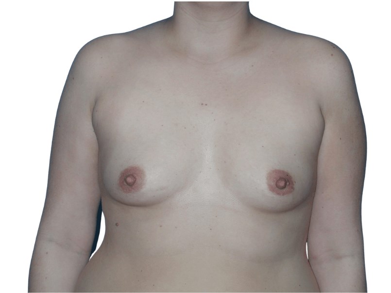 Before Image