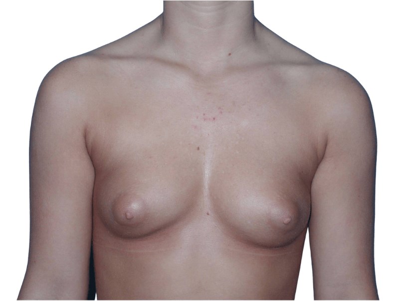 Before Image