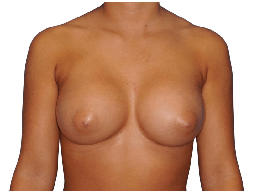 After Image