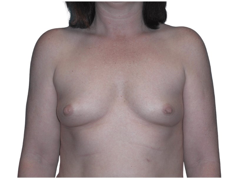 Before Image