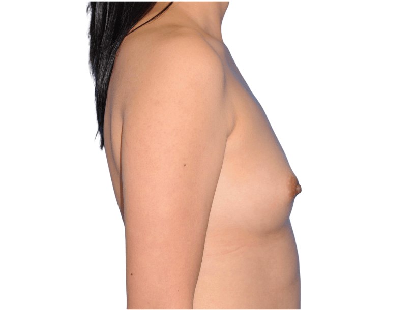 Side View Right Before Side View Right Before