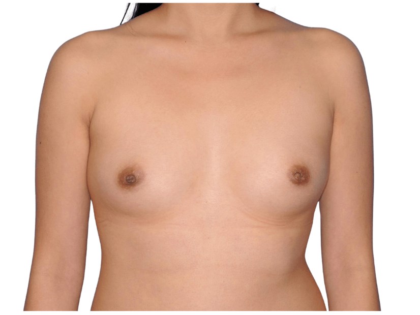 Before Image