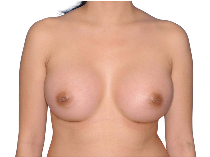 After Image