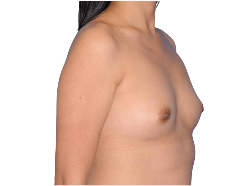 3/4 View Before 3/4 View Before