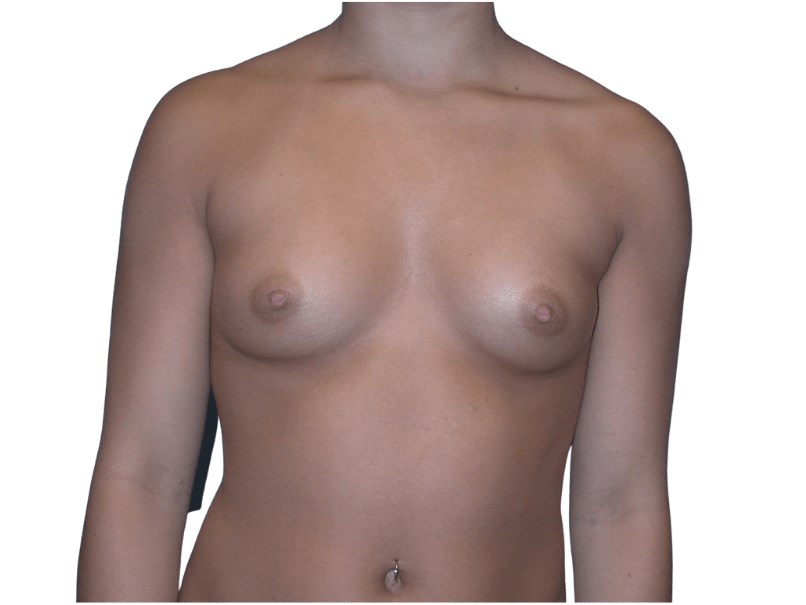Before Image