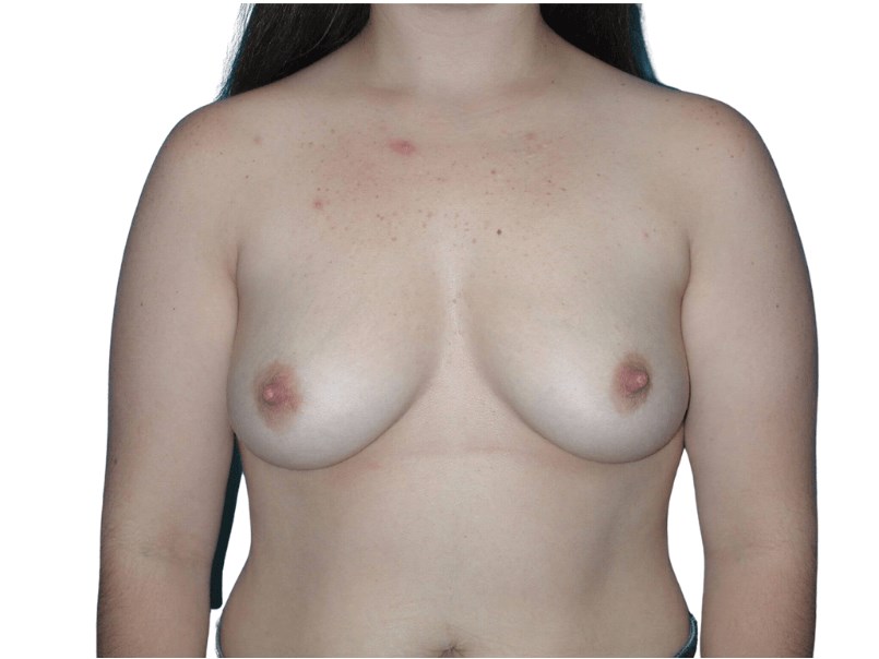 Before Image