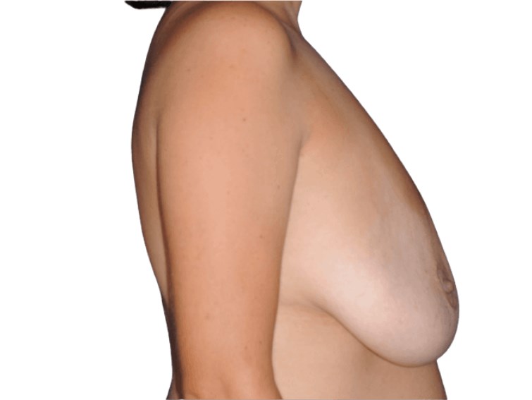 Side Before Side Before