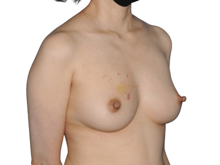 3/4 Before 3/4 Before