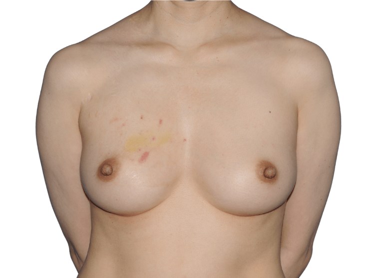 Before Image