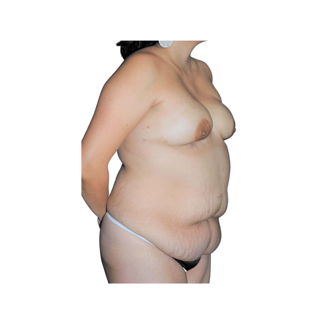 Diagonal view Before