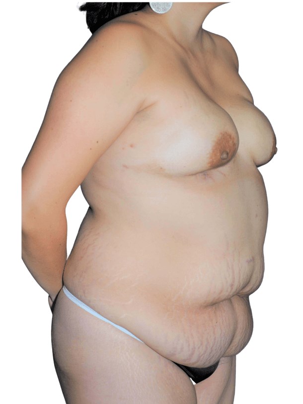 Diagonal view Before