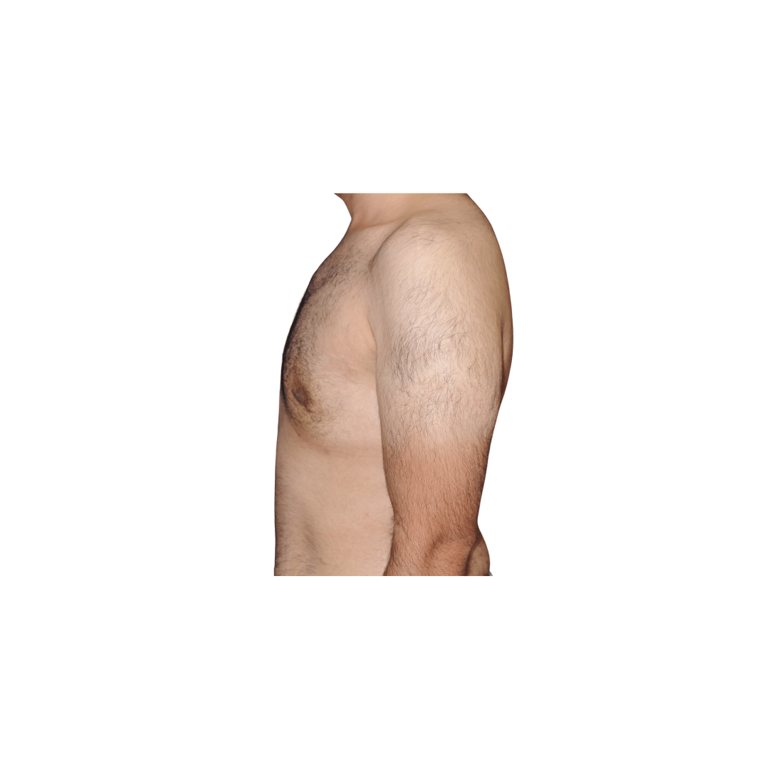 Lateral left view After