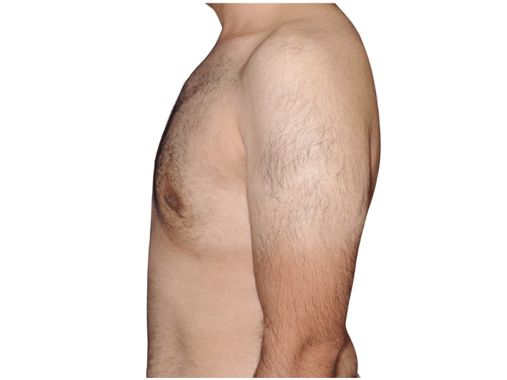 Lateral left view After