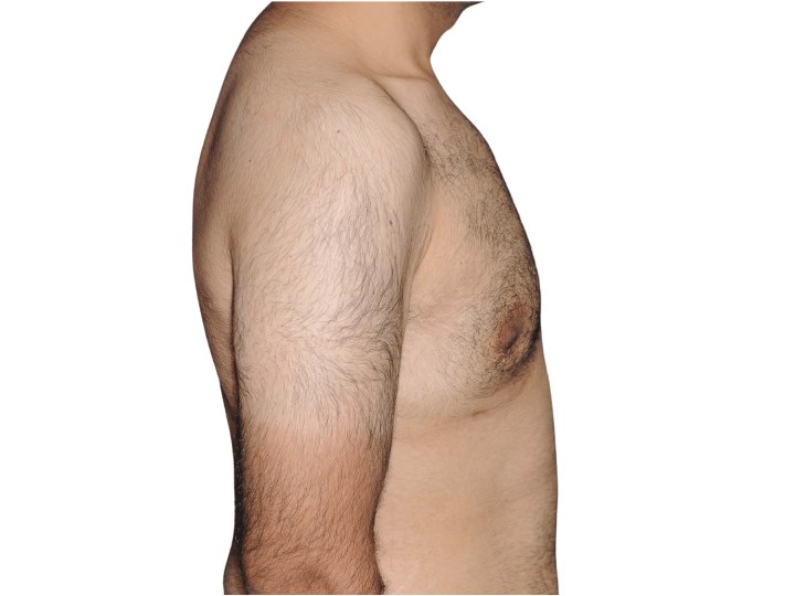 Lateral right view After