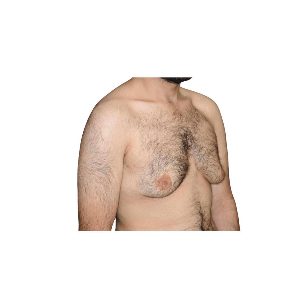 Diagonal view Before