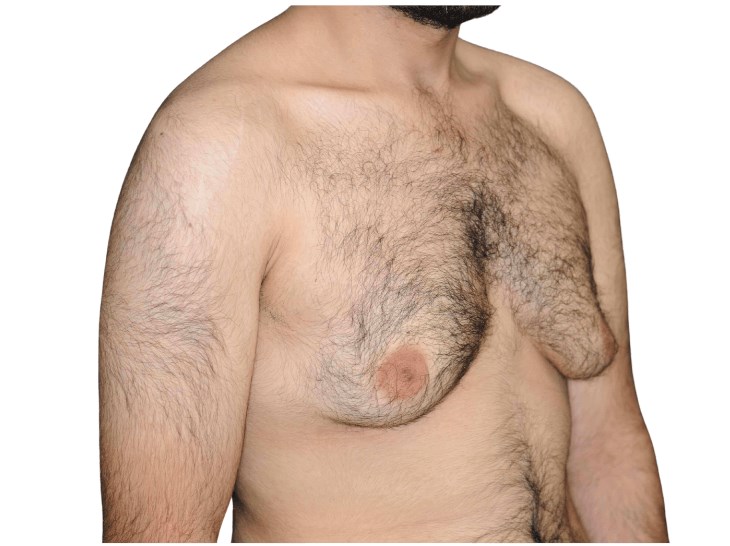 Diagonal view Before