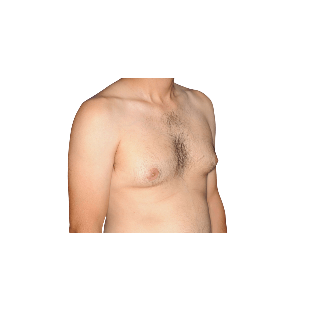 Diagonal view Before