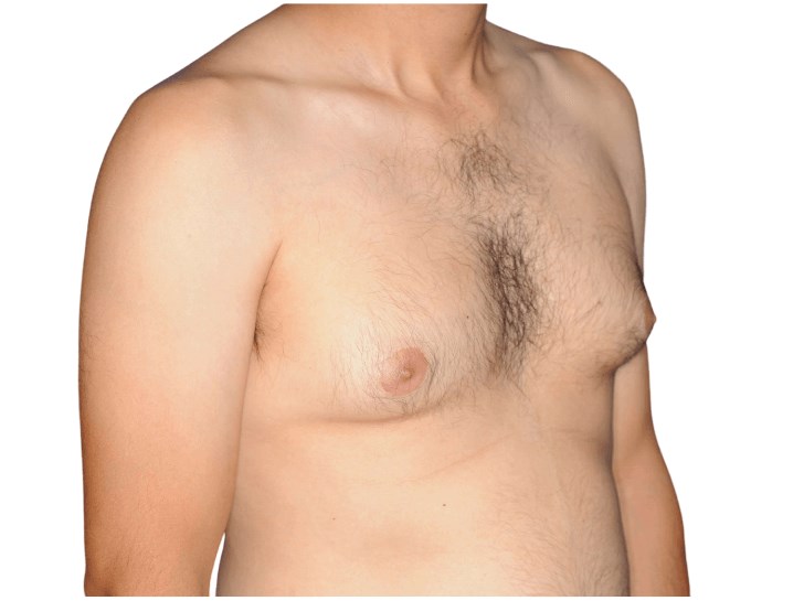 Diagonal view Before