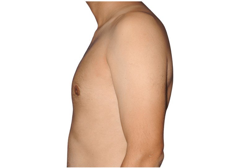 Lateral left view After