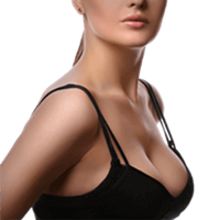 Breast Reduction