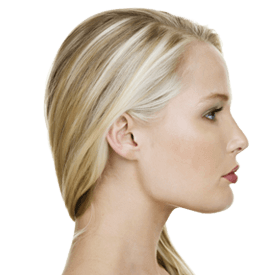 Rhinoplasty