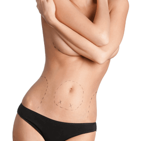 Body Contouring