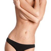 Body Contouring